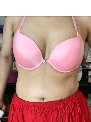 Screenshot_2018-12-17 https www breastimplantsbymentor com(19).png