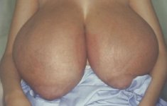 my boobs now 1.jpg