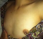 breast-1.jpg