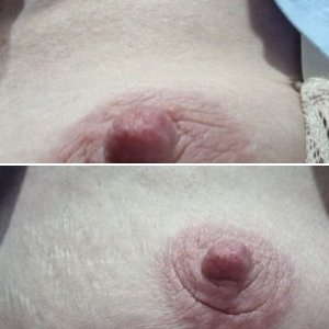 Tit Flash Nipple